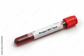 DENGUE Ns 1 TEST