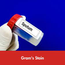 SPUTUM GRAM TEST