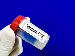 SPUTUM CULTURE TEST