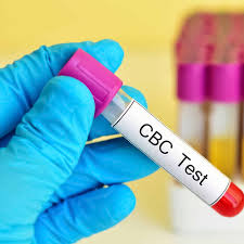 CBC Test