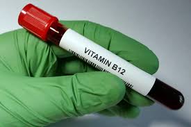 Vitamin B 12 Test